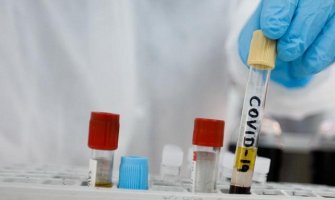 Češki analitičar: Sa koronavirusom su bolje prošle države u kojima su političari radije slušali stručnjake