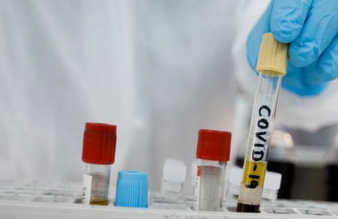 Češki analitičar: Sa koronavirusom su bolje prošle države u kojima su političari radije slušali stručnjake