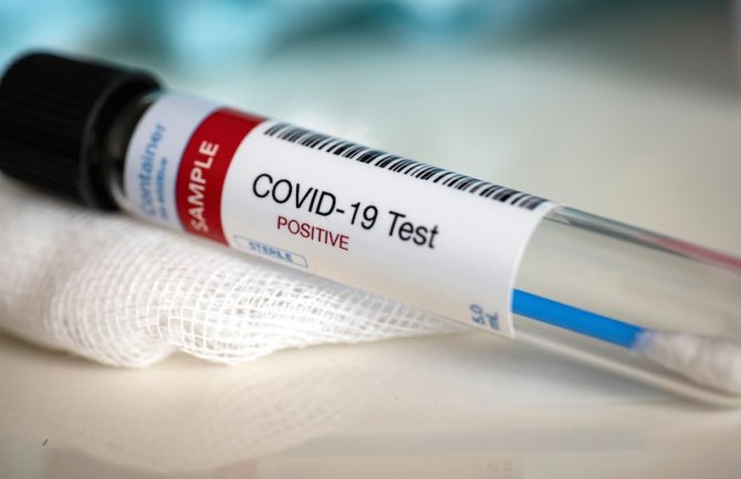 Još 57 novih slučajeva koronavirusa, prijavljena tri smrtna slučaja