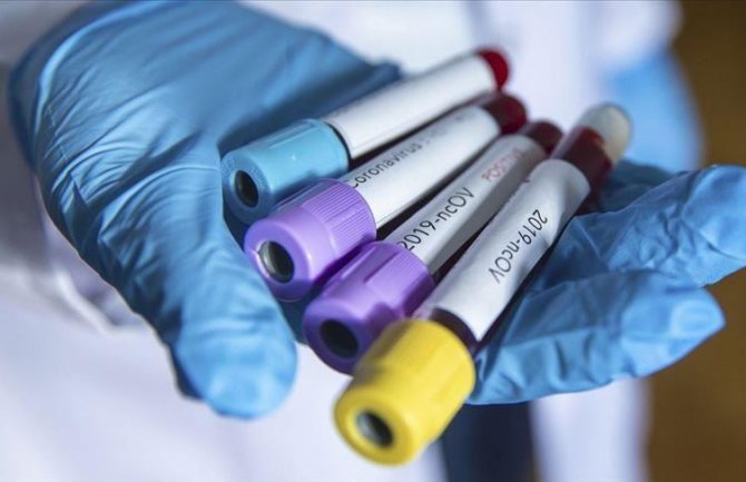 Rizik za zarazu koronavirusom ne zavisi mnogo od krvne grupe