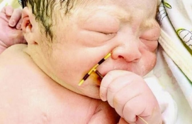 Beba se rodila i raskrinkala majku: Ponijela suvenir sa sobom