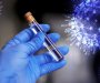 Američki naučnici otkrili kako koronavirus vara imuni sistem