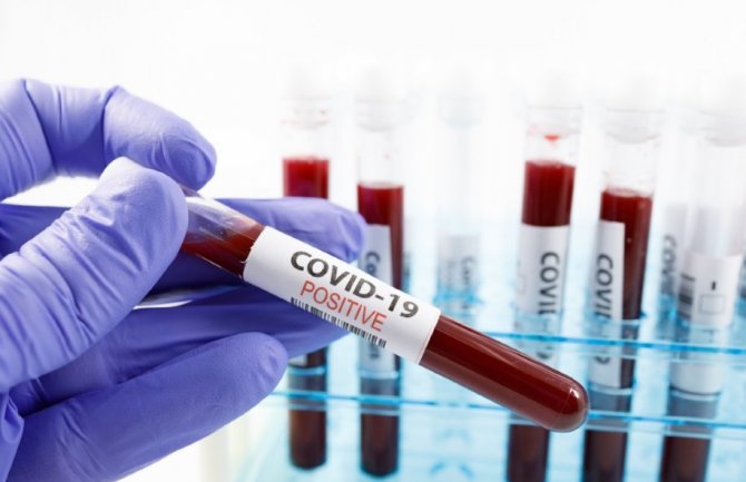 Još jedna žrtva koronavirusa u Crnoj Gori, 43 novooboljela pacijenta