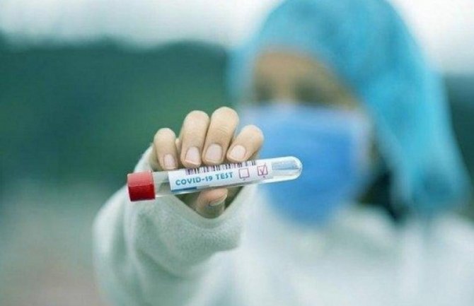 Na Kosovu 224 novih slučajeva koronavirusa, preminulo devet osoba 