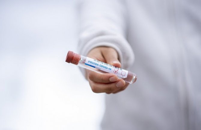 Britanska vlada nabavila brze testove za koronavirus, rezultati za 90 minuta