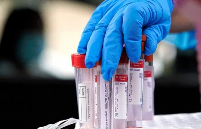 Srbija planira uvođenje obaveznog PCR testa i izolaciju za strance
