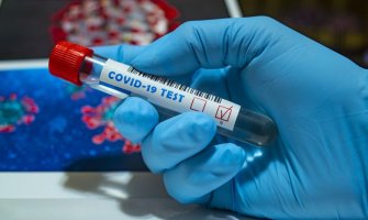  11 dokazanih simptoma koronavirusa koje ne bi trebalo da ignorišete 