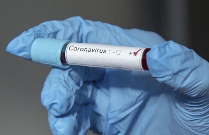 Na Kosovu potvrđen 141 novi slučaj koronavirusa, 11 osoba preminulo 