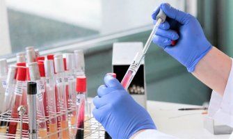 Švajcarski naučnici najavili brzi test na koronavirus: Rezultati nalaza gotovi za 15 minuta