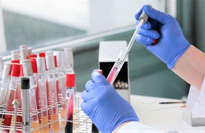 Švajcarski naučnici najavili brzi test na koronavirus: Rezultati nalaza gotovi za 15 minuta