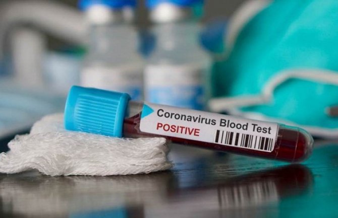 U BiH potvrđena 293 nova slučaja koronavirusa, devet osoba preminulo 