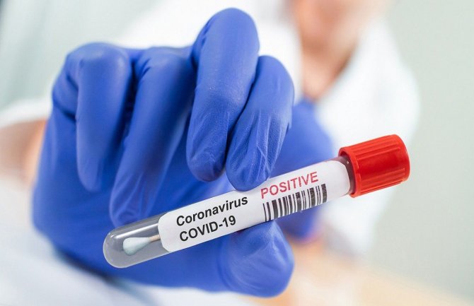 U poslednja 24 sata na Kosovu bez žrtava od koronavirusa