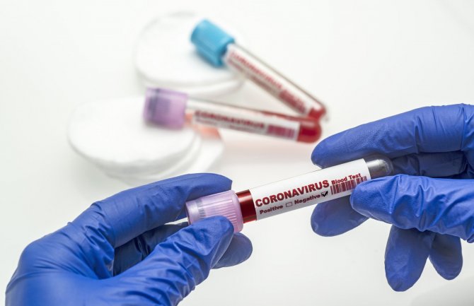 Danas 235 novih slučajeva koronavirusa, tri osobe preminule