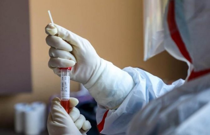 Na Kosovu još 166 novih slučajeva zaraze kovidom, preminula dva pacijenta