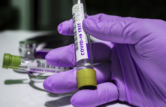 Danas u regionu zabilježen najmanji broj novih slučajeva koronavirusa