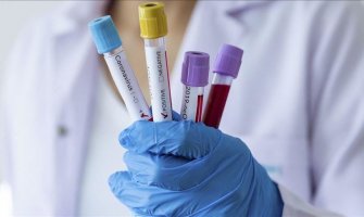 EU izdvaja 100 miliona eura za brze testove na koronavirus