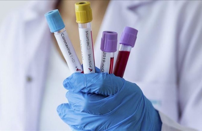 EU izdvaja 100 miliona eura za brze testove na koronavirus