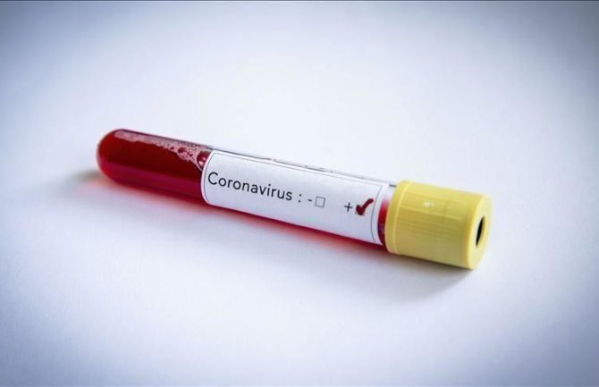 U Grčkoj potvrđeno 436 slučaja koronavirusa, sedam smrtnih ishoda 