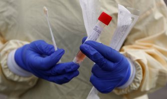 SAD: U prodaji brzi test na koronavirus za ličnu upotrebu