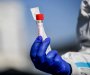 Novi presjek IJZ: Bez preminulih od posljedica koronavirusa, registrovan 41 slučaj zaraze