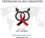 LGBT Forum Progres pozvao svoje članove na besplatno testiranje na HIV