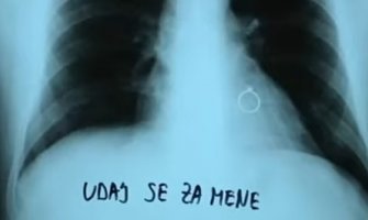 Najljepši snimak pluća koji doktorka može da pogleda: Prsten na srcu nakon preležane bolesti (Video)