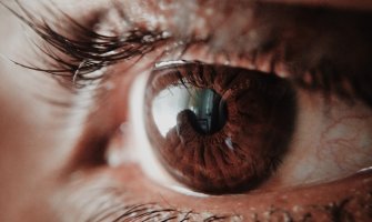 Britanac prva osoba na svijetu koja je dobila 3D štampano oko