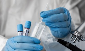 Novi presjek IJZ: Bez preminulih od posljedica koronavirusa, registrovano 56 slučajeva