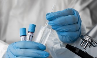 Novi presjek IJZ: Bez preminulih od posljedica koronavirusa, registrovano 59 slučajeva zaraze