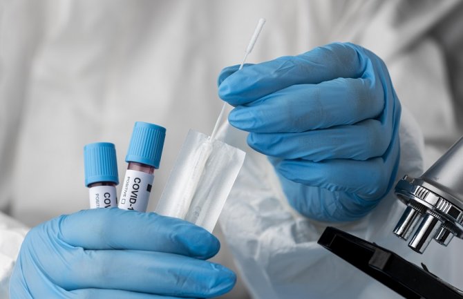 Novi presjek IJZ: Bez preminulih od posljedica koronavirusa, registrovano 56 slučajeva
