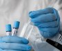 IJZ: Za sedam dana 110 novih slučajeva koronavirusa