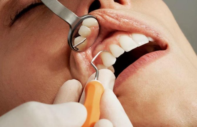 Uskoro bez straha od zubara: Ljudima će nicati treći zubi