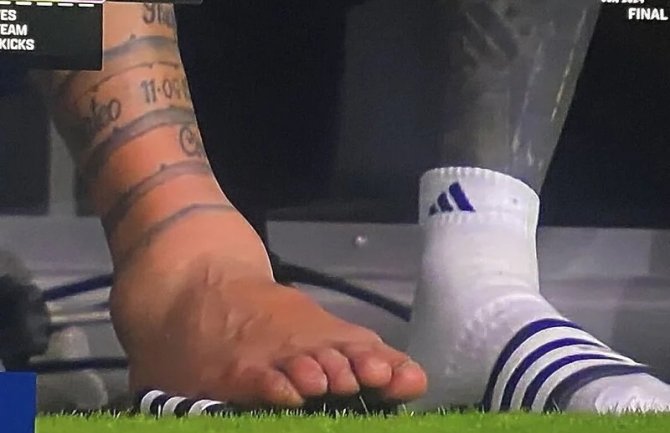 Messijev zglob nakon povrede izgleda potpuno nevjerovatno, šokirao je sve kada je skinuo štucne